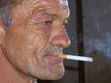 Smoker with wrinkles all over face